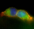 $870,000 to help develop stem cell treatments for septic shock, glaucoma, lung injury and muscle degeneration