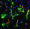 Pourrait-on dire adieu aux migraines en ciblant la perm&#233;abilit&#233; momentan&#233;e des vaisseaux sanguins? Une &#233;tude ouvre une nouvelle avenue de recherche prometteuse