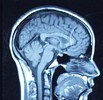 Brain Health Awareness Week: October 15-19