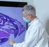 L’H&#244;pital d’Ottawa en mission pour d&#233;crypter la maladie de Parkinson